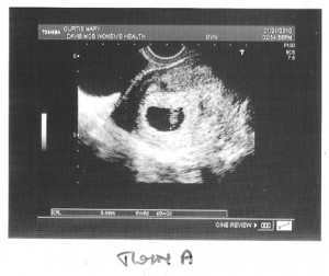 twina_1st_photo_wb Twin A's first photo.