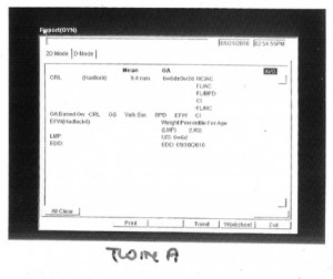 twina_1st_stats_wb Twin A's stats, the little one at 9.4 mm, that's less than half an inch.