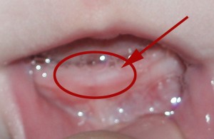 Close-up of his first pearly white